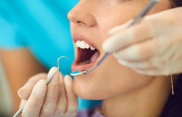 Is It Time For You To Get A Dental Bridge?
