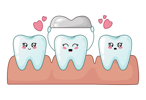 How Long Should My New Dental Crown Last?