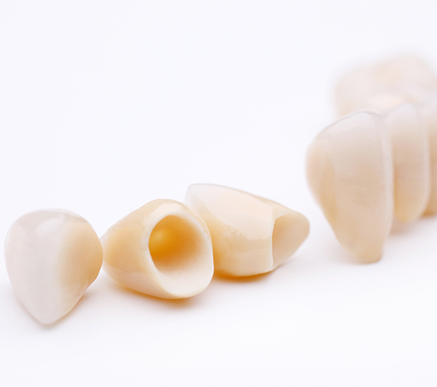Mableton Dental Crowns and Dental Bridges