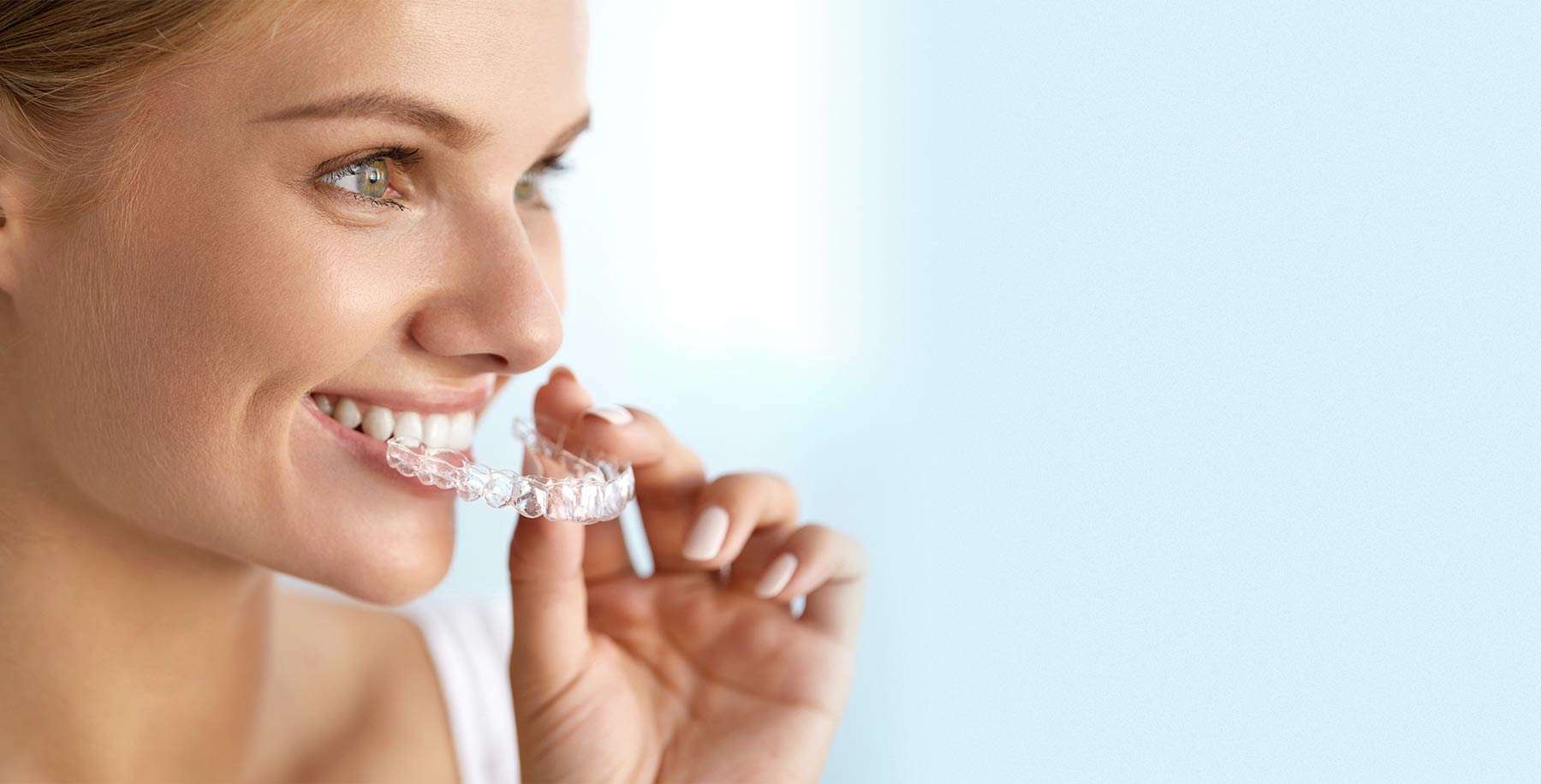 Invisalign