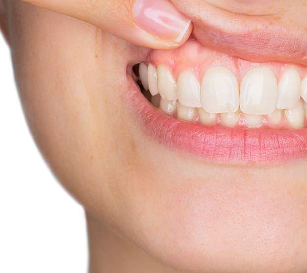 Mableton Gum Disease
