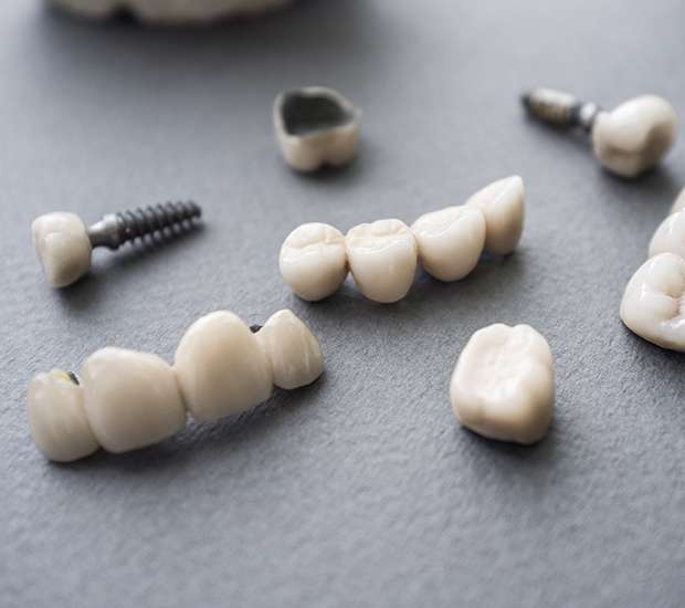 Mableton The Difference Between Dental Implants and Mini Dental Implants