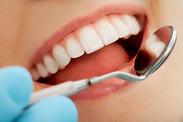 Is Teeth Whitening Right For Everyone?